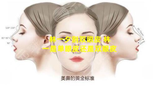 林一夕割双眼皮 林一是单眼皮还是双眼皮